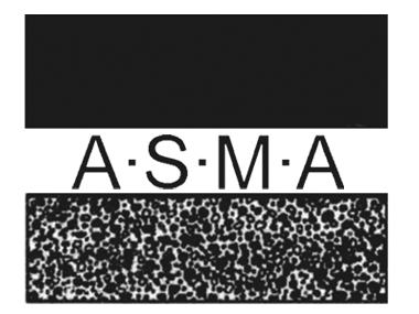 af-asma